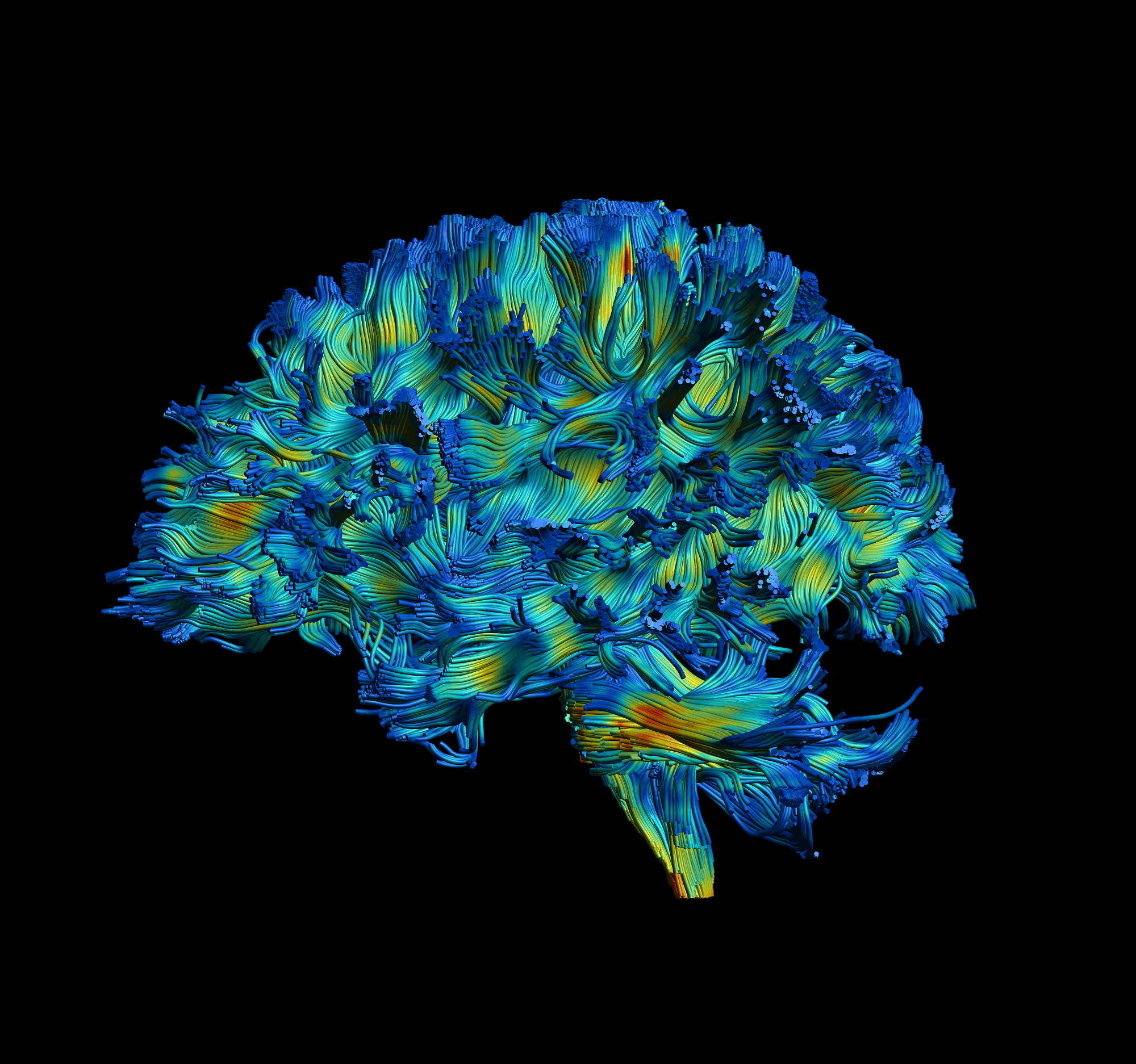 What Does White Matter Say About The Aging Brain