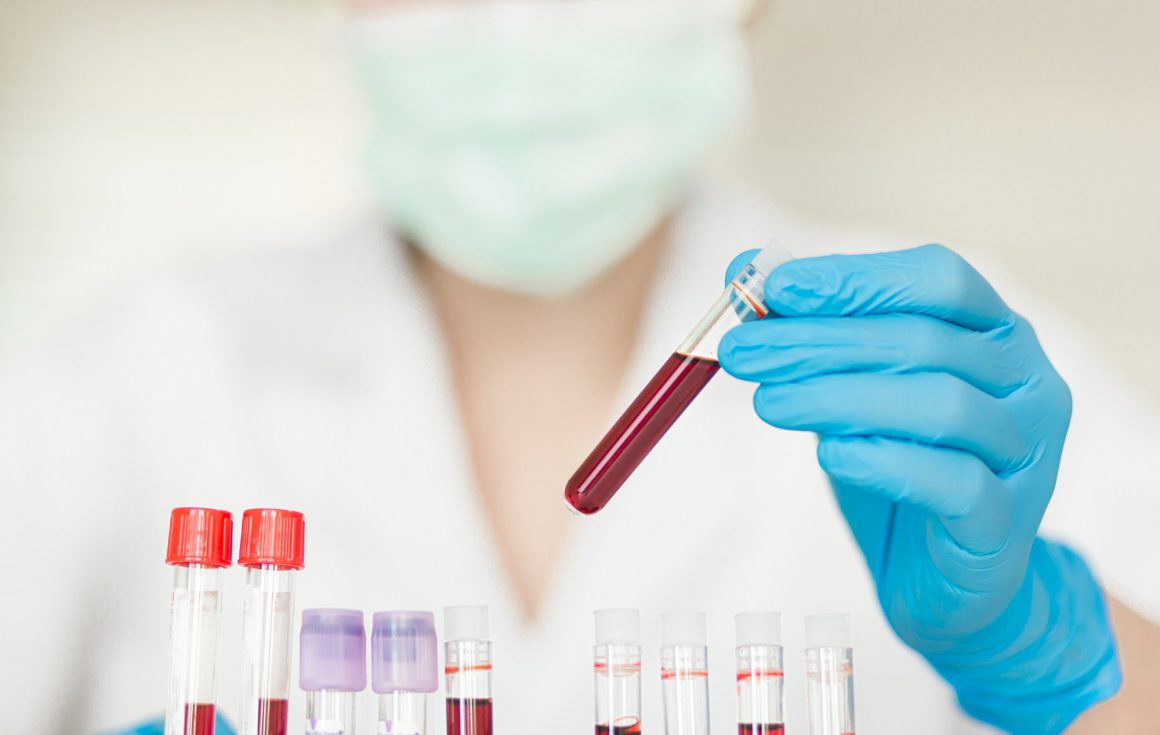 Blood test can diagnose people with Alzheimer’s disease